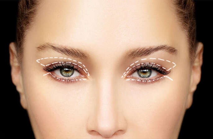 5 Reasons Why Blepharoplasty Might Be Right for You